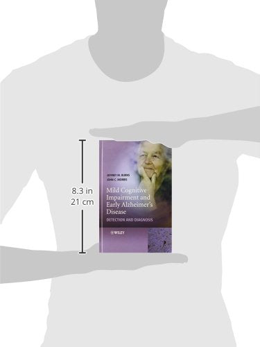 Mild Cognitive Impairment and Early Alzheimer's Disease: Detection and Diagnosis