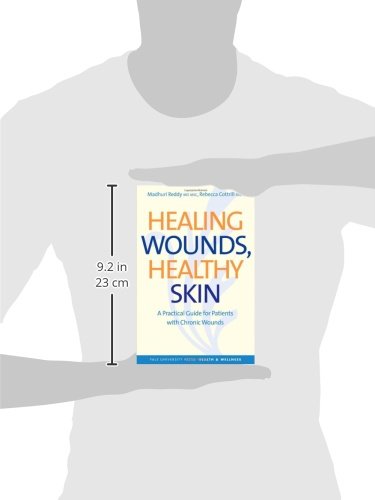 Healing Wounds, Healthy Skin: A Practical Guide for Patients with Chronic Wounds (Yale University Press Health & Wellness)