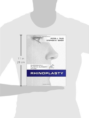 Rhinoplasty