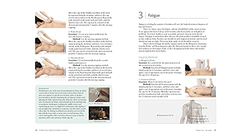 Practical Guide to Cupping Therapy: A Natural Approach to Heal Through Traditional Chinese Medicine