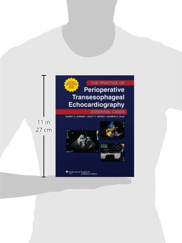 The Practice of Perioperative Transesophageal Echocardiography: Essential Cases