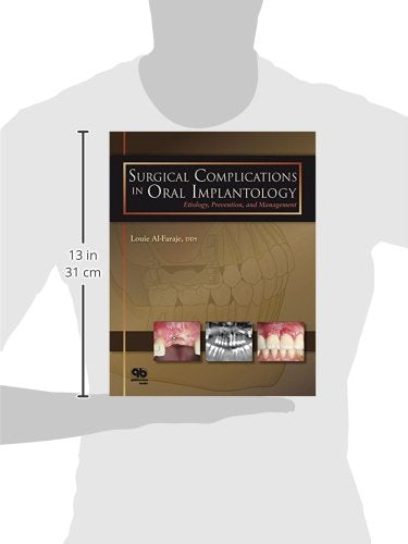 Surgical Complications in Oral Implantology: Etiology, Prevention, and Management