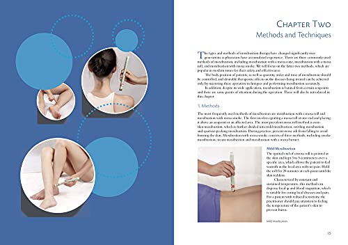 Illustrated Moxibustion Therapy: A Natural Way of Prevention and Treatment through Traditional Chinese Medicine