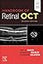 Handbook of Retinal OCT: Optical Coherence Tomography