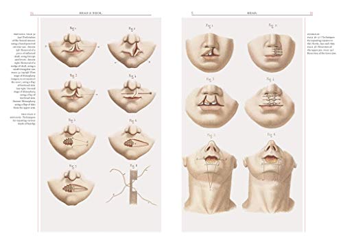 Crucial Interventions: An Illustrated Treatise on the Principles & Practice of Nineteenth-Century Surgery