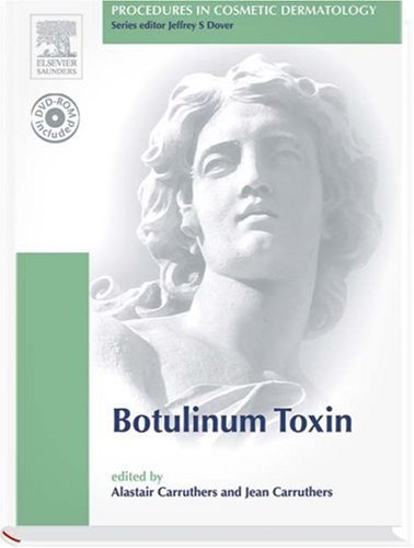 Procedures in Cosmetic Dermatology Series: Botulinum Toxin: