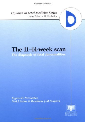 The 11-14-Week Scan: The Diagnosis of Fetal Abnormalities