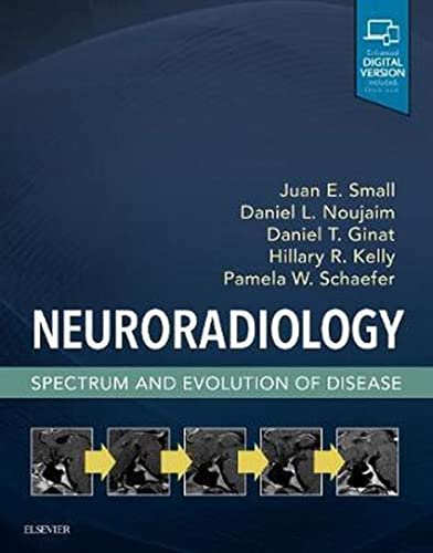 Neuroradiology: Spectrum and Evolution of Disease