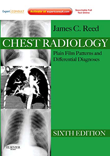 Chest Radiology: Plain Film Patterns and Differential Diagnoses, Expert Consult - Online and Print