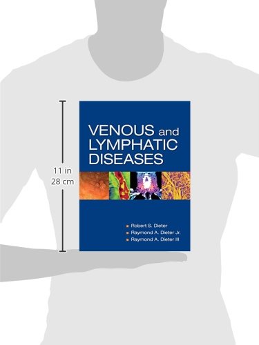 Venous and Lymphatic Diseases