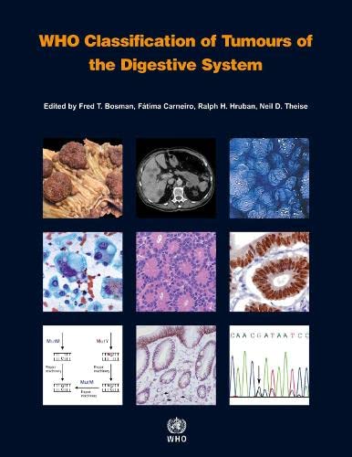 WHO Classification of Tumours of the Digestive System [OP] (Medicine)