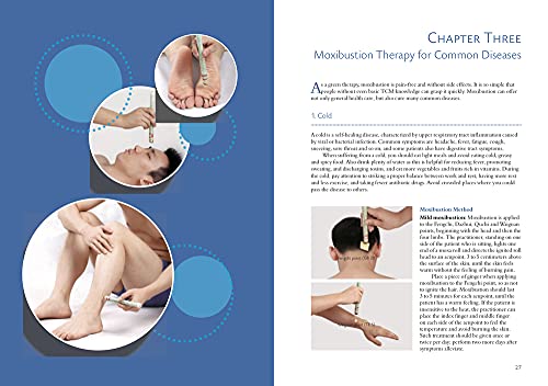 Illustrated Moxibustion Therapy: A Natural Way of Prevention and Treatment through Traditional Chinese Medicine