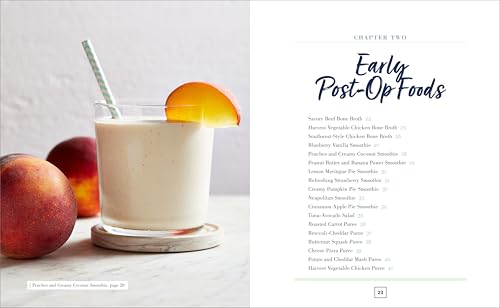 The High-Protein Bariatric Cookbook: Essential Recipes for Recovery and Lifelong Weight Management
