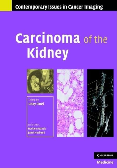 Carcinoma of the Kidney (Contemporary Issues in Cancer Imaging)