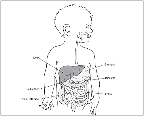 Childhood Cancer: A Parent's Guide to Solid Tumor Cancers (Childhood Cancer Guides)