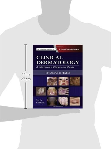 Clinical Dermatology: A Color Guide to Diagnosis and Therapy
