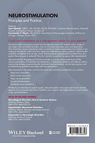 Neurostimulation: Principles and Practice