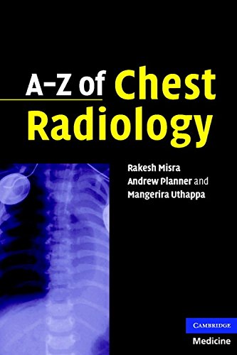 A-Z of Chest Radiology by Planner, Andrew