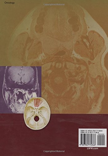 Head and Neck Cancer: A Multidisciplinary Approach
