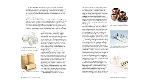 Practical Guide to Cupping Therapy: A Natural Approach to Heal Through Traditional Chinese Medicine