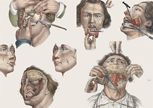 Crucial Interventions: An Illustrated Treatise on the Principles & Practice of Nineteenth-Century Surgery
