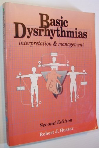 Basic Dysrhythrams Interpretations & Management