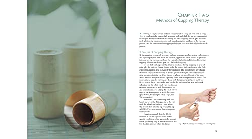 Practical Guide to Cupping Therapy: A Natural Approach to Heal Through Traditional Chinese Medicine