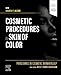 Procedures in Cosmetic Dermatology: Cosmetic Procedures in Skin of Color