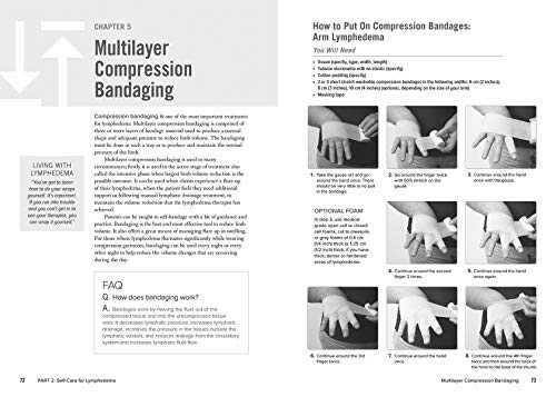 The Complete Lymphedema Management and Nutrition Guide: Empo
