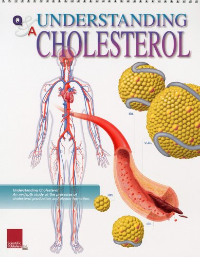 Understanding Cholesterol Flip Chart