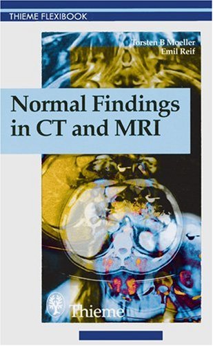 Normal Findings in Ct and Mri (Thieme Flexibook)