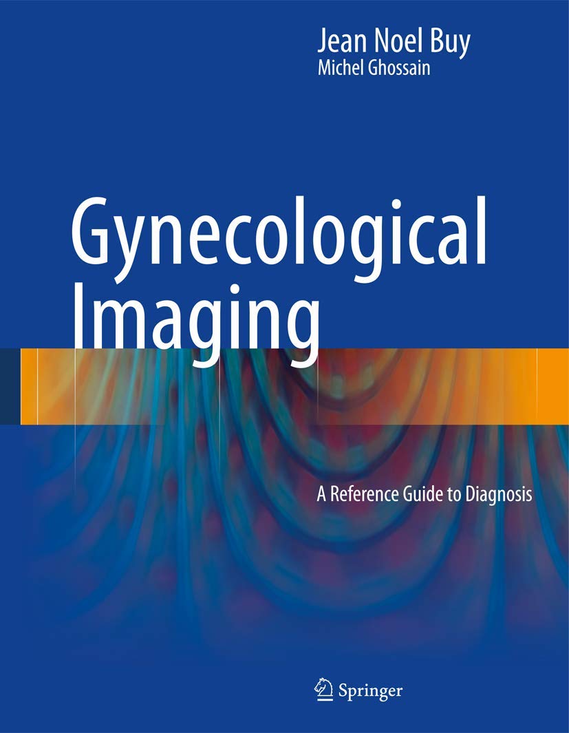 Gynecological Imaging: A Reference Guide to Diagnosis