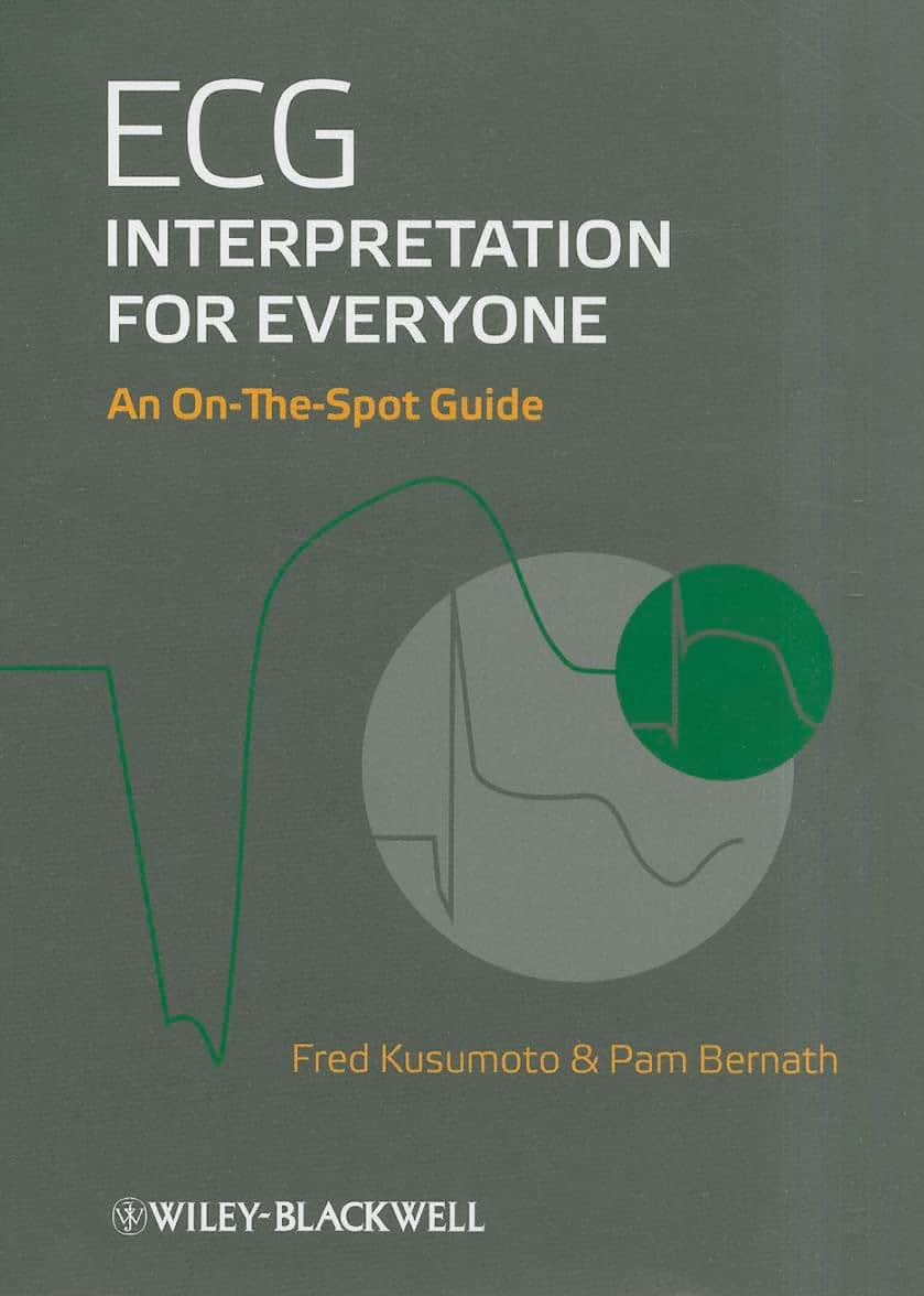 ECG Interpretation for Everyone: An On-The-Spot Guide