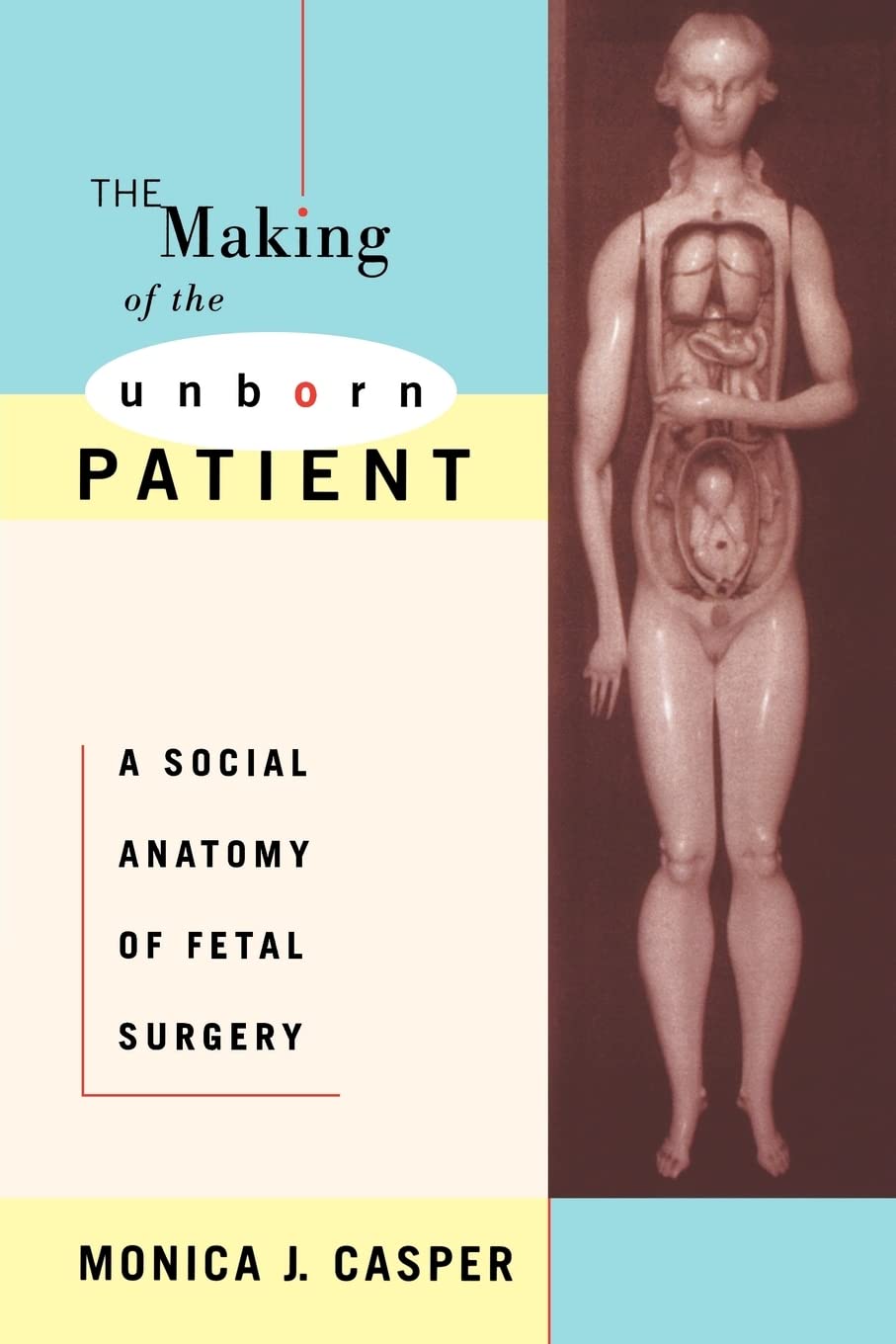 The Making of the Unborn Patient: A Social Anatomy of Fetal Surgery