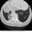 CURRENT Medical Diagnosis and Treatment 2019 by Papadakis, M
