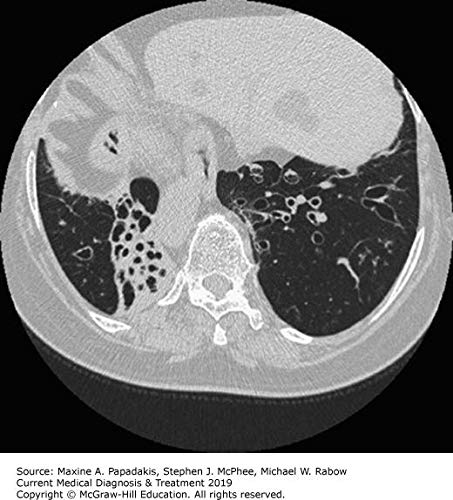 CURRENT Medical Diagnosis and Treatment 2019 by Papadakis, M