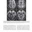 Nolte's The Human Brain: An Introduction to its Functional Anatomy