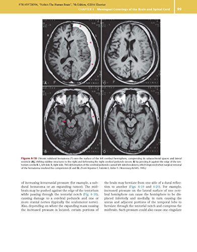 Nolte's The Human Brain: An Introduction to its Functional Anatomy