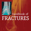 Handbook of Fractures, Third Edition