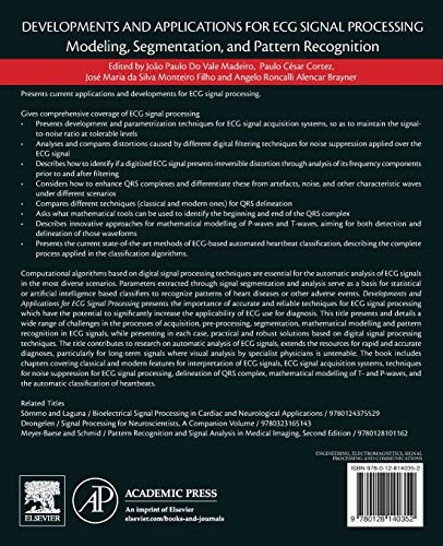 Developments and Applications for ECG Signal Processing: Modeling, Segmentation, and Pattern Recognition