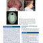 Before We Are Born: Essentials of Embryology and Birth Defects