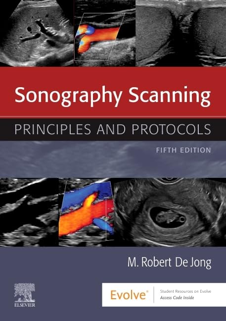 Sonography Scanning by deJong RDMS RDCS RVT FSDMS, M. Robert