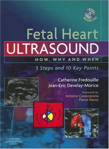 Fetal Heart Ultrasound: How, Why and When by Fredouille MD,