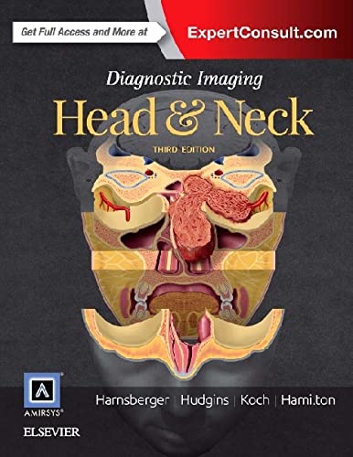 Diagnostic Imaging: Head and Neck by Koch MD, Bernadette L.