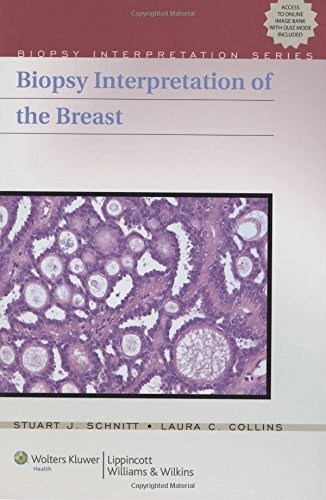 Biopsy Interpretation of The Breast