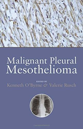 Malignant Pleural Mesothelioma