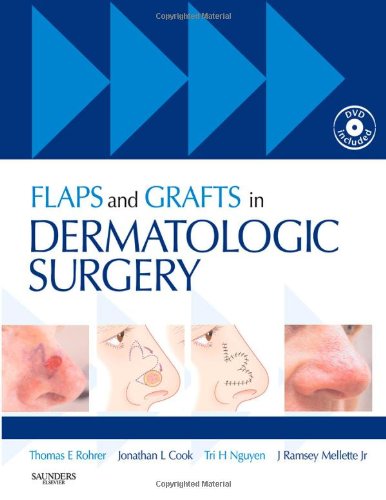 Flaps and Grafts in Dermatologic Surgery: Text with DVD