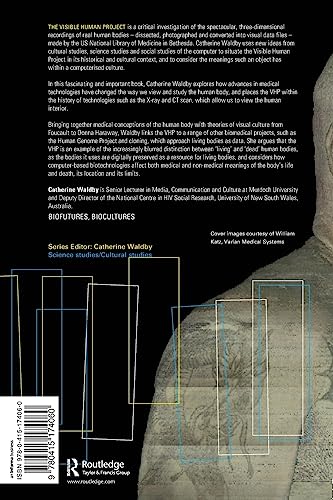 The Visible Human Project