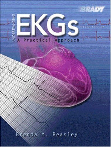 Understanding EkGs: A Practical Approach