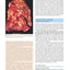 Robbins & Cotran Pathologic Basis of Disease (Robbins Pathology)
